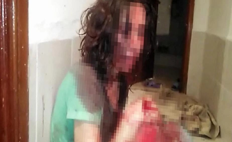 Kocasından öldüresiye dayak yiyen kadını polis kurtardı